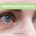 आंखो की एलर्जी के घरेलू उपाय