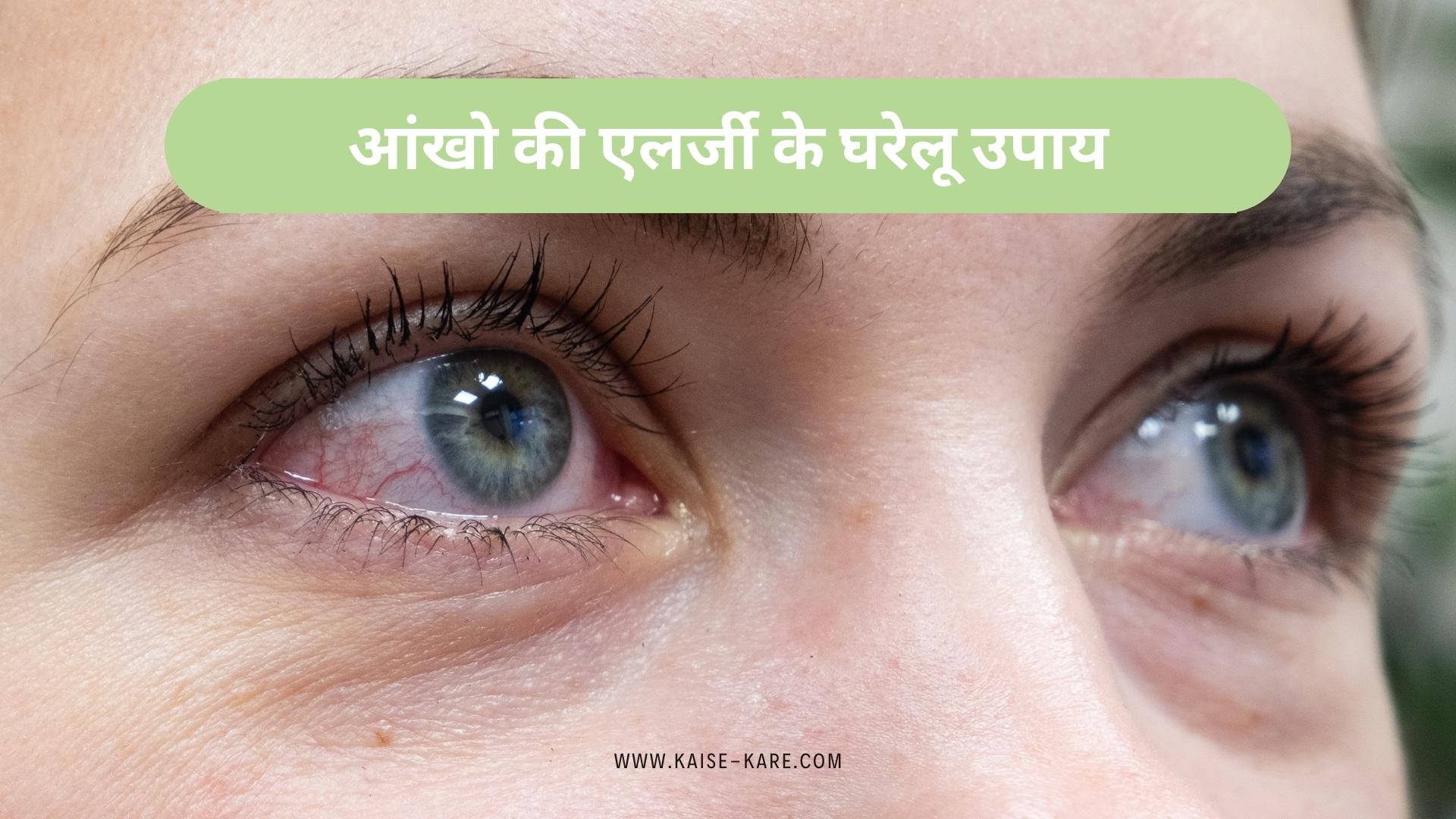 आंखो की एलर्जी के घरेलू उपाय